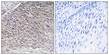 MAST4 rabbit pAb Antibody