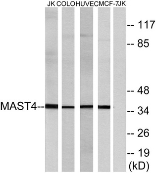 MAST4 rabbit pAb Antibody