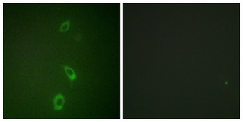 ROM-K antibody