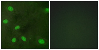 KIR3.1 (phospho Ser185) rabbit pAb Antibody