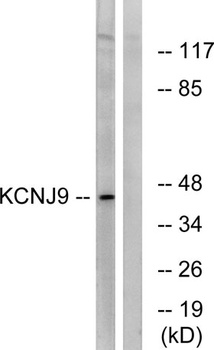 KIR3.3 antibody