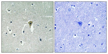 KIR6.2 (phospho Thr224) rabbit pAb