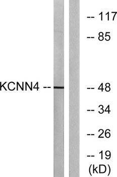 IK1 rabbit pAb Antibody