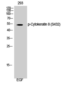 Cytokeratin 8 (phospho-Ser432) antibody