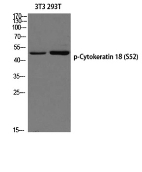 Cytokeratin 18 (phospho-Ser52) antibody