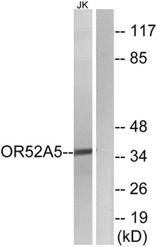 Olfactory receptor 52A5 antibody