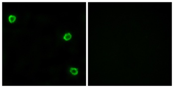 Olfactory receptor 51Q1 rabbit pAb