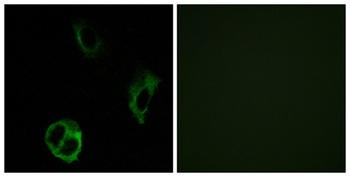 Olfactory receptor 51I1 rabbit pAb