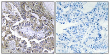 Laminin β-2 rabbit pAb