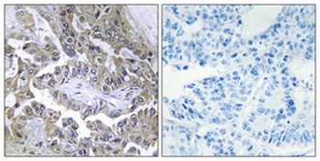 Laminin beta-2 antibody