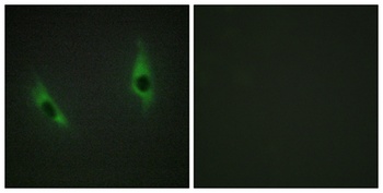 Laminin beta-3 antibody