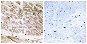 ARHGAP1 antibody