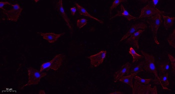 Lck (phospho Tyr393) rabbit pAb