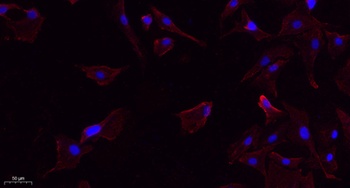 Lck (phospho-Tyr393) antibody