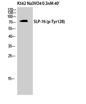 SLP-76 (phospho Tyr128) rabbit pAb