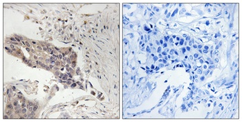 SLP-76 antibody