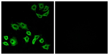 Rho H antibody