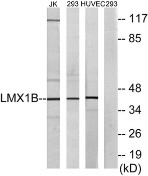 LMX1B antibody