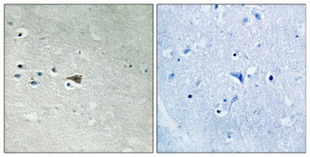 Arrestin-β-1 (phospho Ser412) rabbit pAb