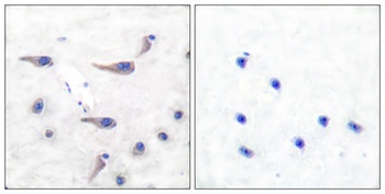 MARCKS (phospho-Ser163) antibody