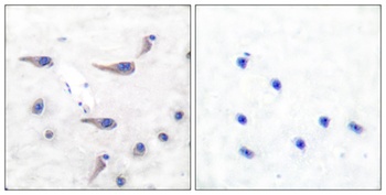 MARCKS (phospho Ser163) rabbit pAb