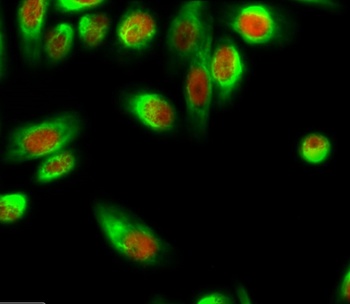 Smad4 antibody