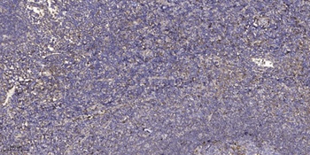 MAGE-9 antibody