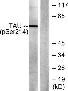Tau (phospho Ser214) rabbit pAb