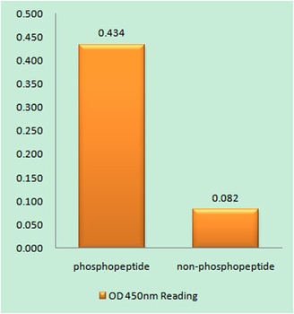 Tau (phospho-Ser262) antibody