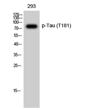 Tau (phospho-Thr181) antibody
