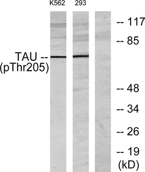 Tau (phospho Thr205) rabbit pAb Antibody