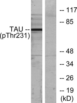 Tau (phospho-Thr231) antibody