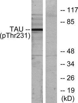 Tau (phospho Thr231) rabbit pAb