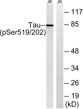 Tau (phospho-Ser519) antibody