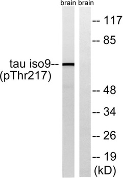 Tau (phospho-Thr534) antibody