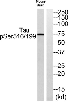Tau (phospho-Ser516/199) antibody