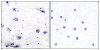 Tau (phospho-Ser422) antibody