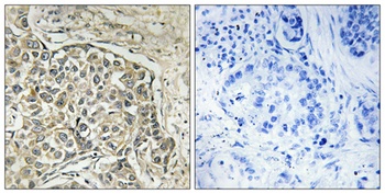 Arylsulfatase D rabbit pAb Antibody