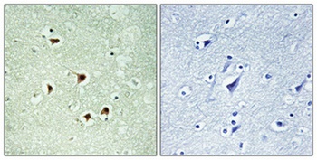 Max (phospho-Ser2) antibody