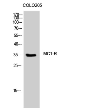 MC1-R antibody