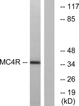 MC4-R rabbit pAb