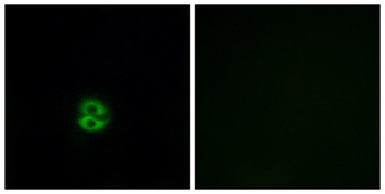 CHST6 antibody