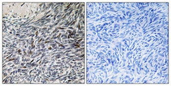 MCM4 antibody