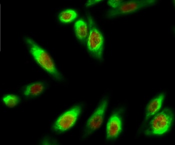 MDM2 (phospho-Ser166) antibody