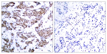MEF-2 (phospho Thr312) rabbit pAb