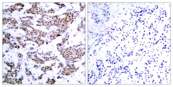 MEF-2 (phospho-Thr312) antibody