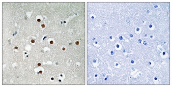 MEF-2C (phospho Ser396) rabbit pAb