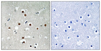 MEF-2C (phospho-Ser396) antibody