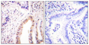 MEF-2D (phospho Ser444) rabbit pAb Antibody
