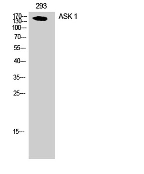 ASK 1 antibody